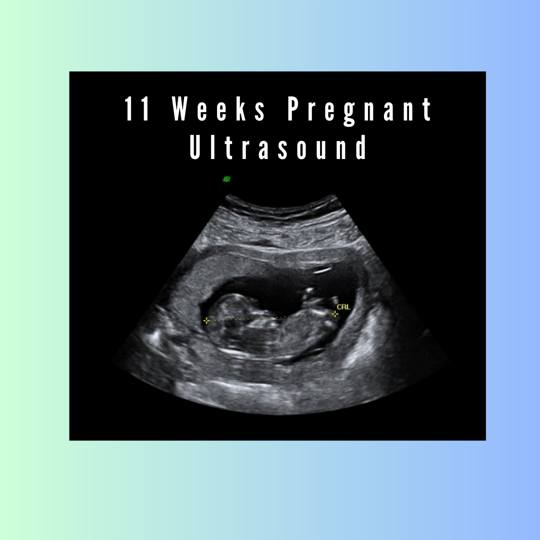 Wonder weeks 11 2024 weeks