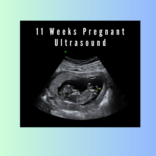 11 Weeks Pregnant Ultrasound