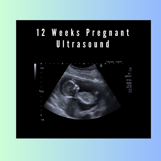 12 Weeks Pregnant Ultrasound