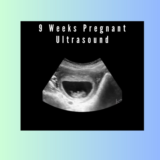 9 Weeks Pregnant Ultrasound
