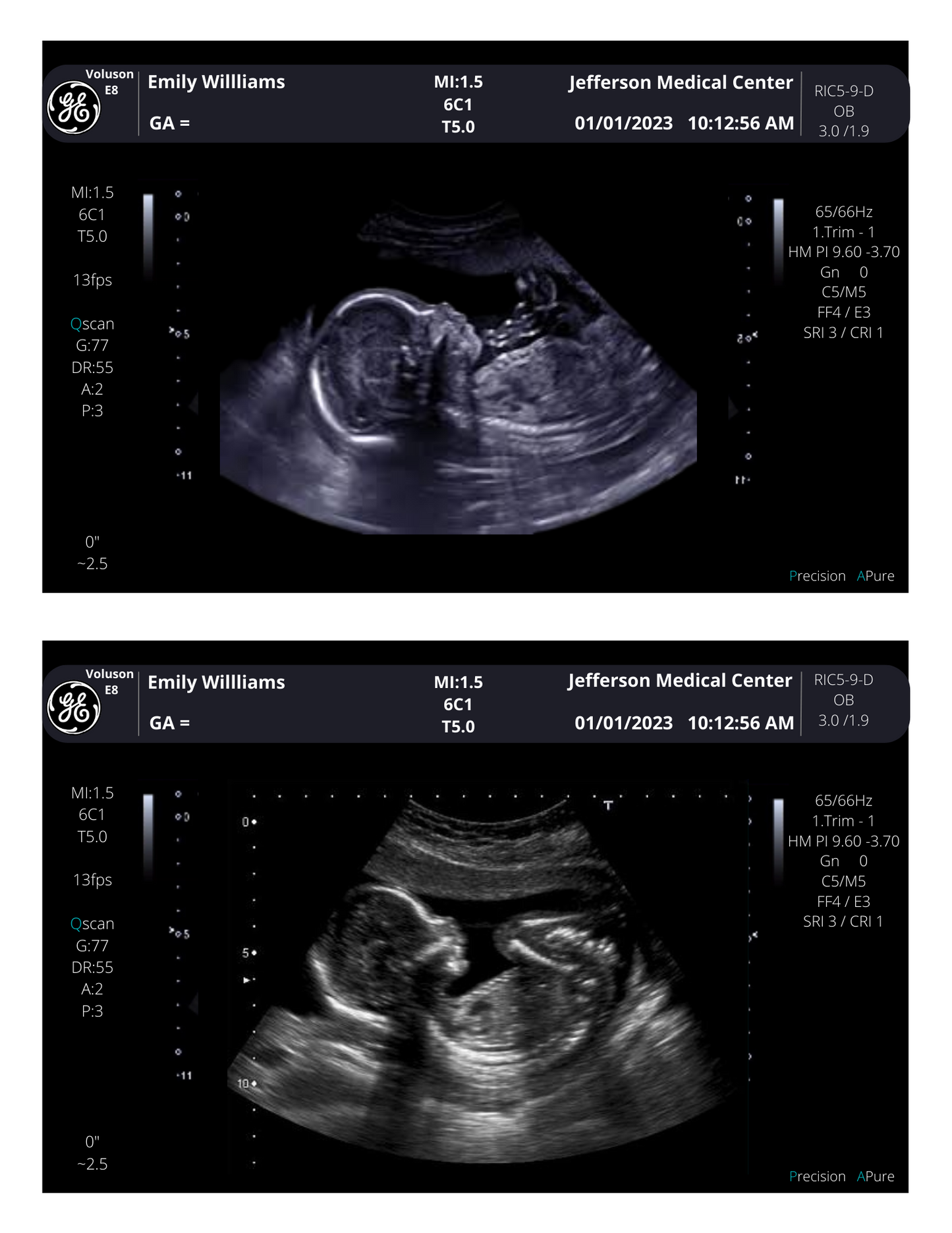 PRINTED & SHIPPED!!  Customizable Sonogram Picture | Personalized Fake Ultrasound Picture |