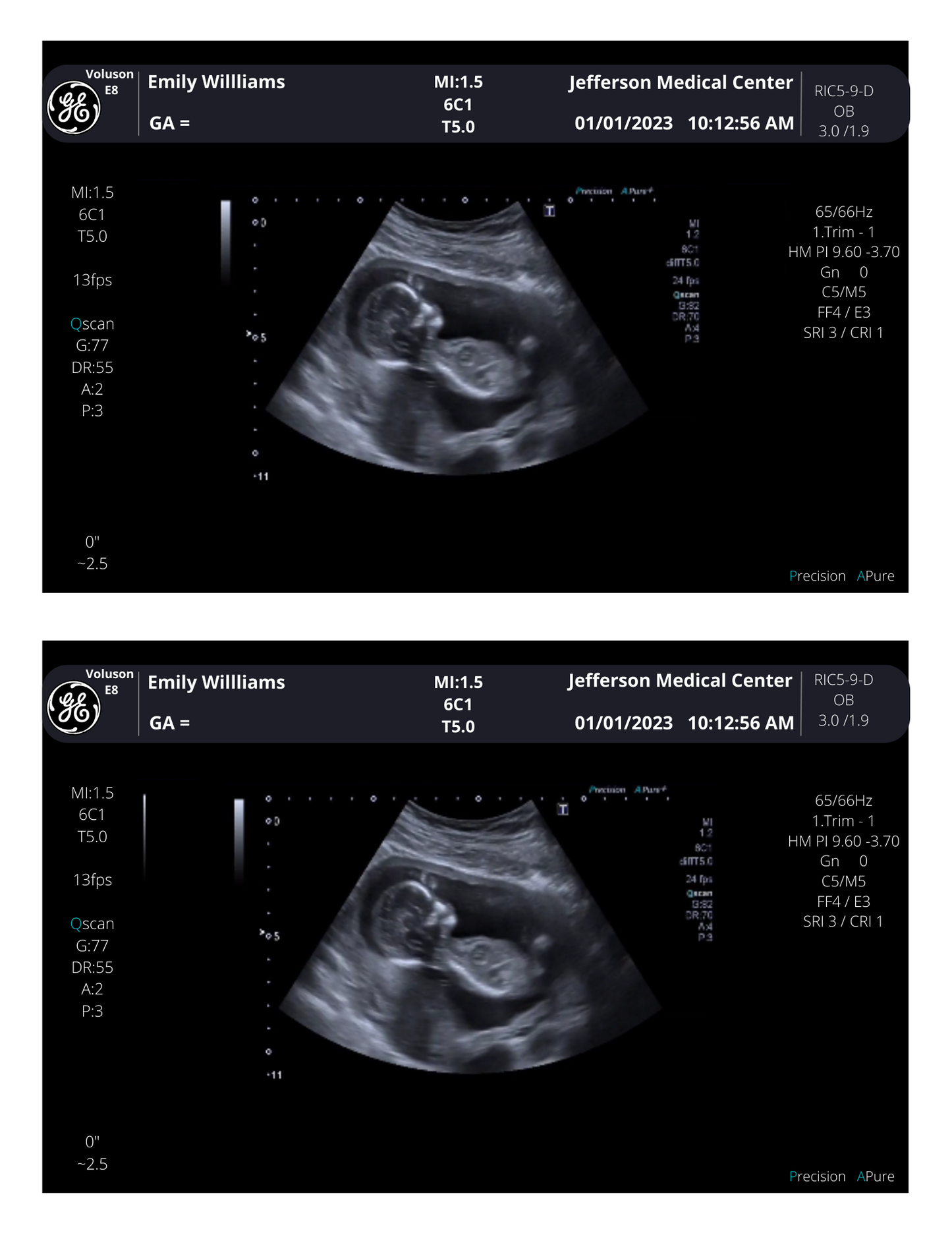 Personalized Fake Ultrasound Sonogram Picture!! From 3-40 weeks!