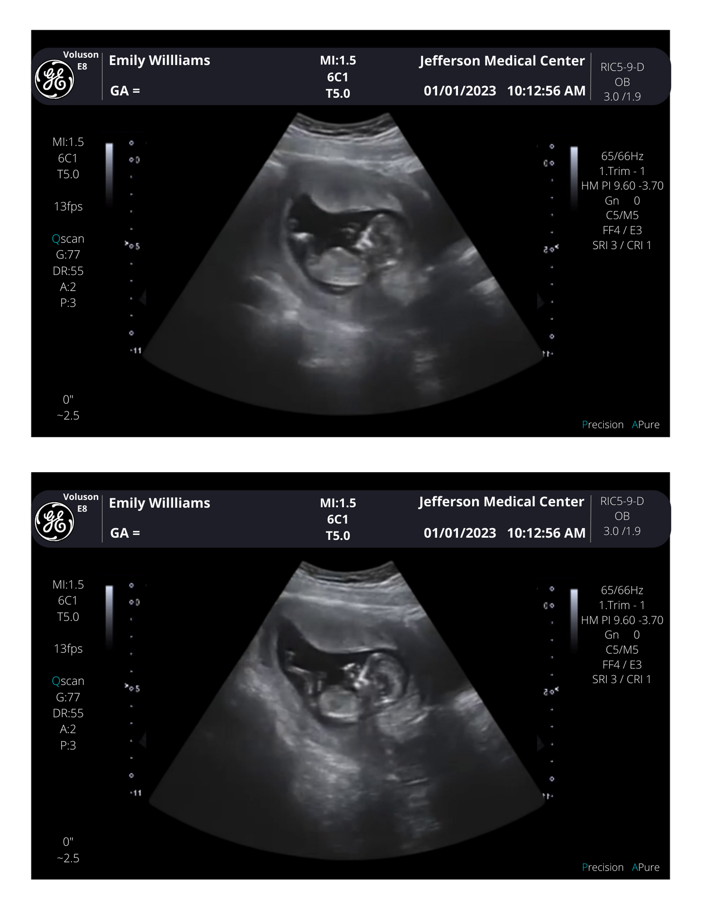 Customizable Digital Ultrasound Downloads | Fake Sonogram Picture |