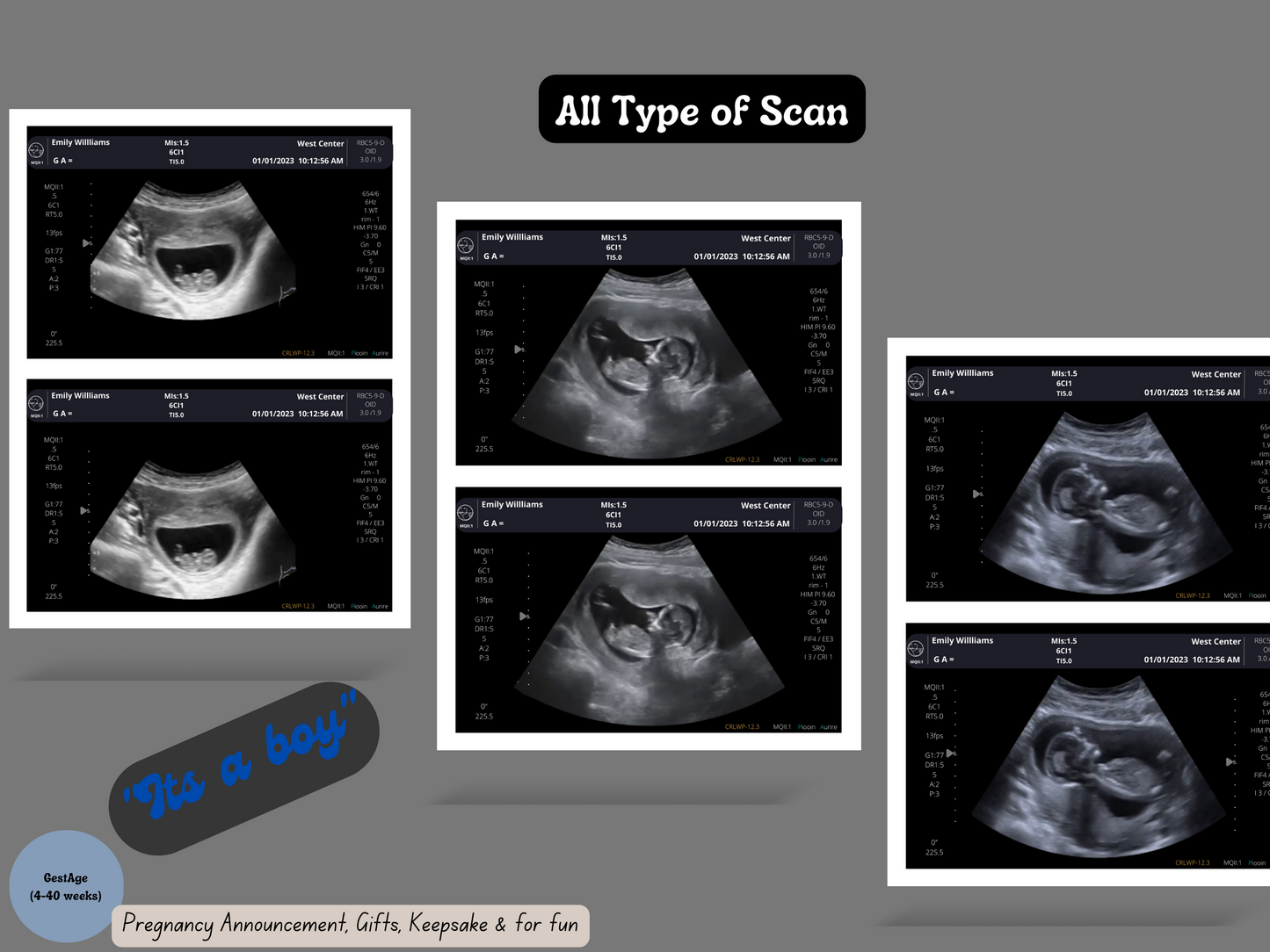 On SALE!! Fake Ultrasound Picture | INSTANT DOWNLOAD!! Customized Digital Sonogram Picture |