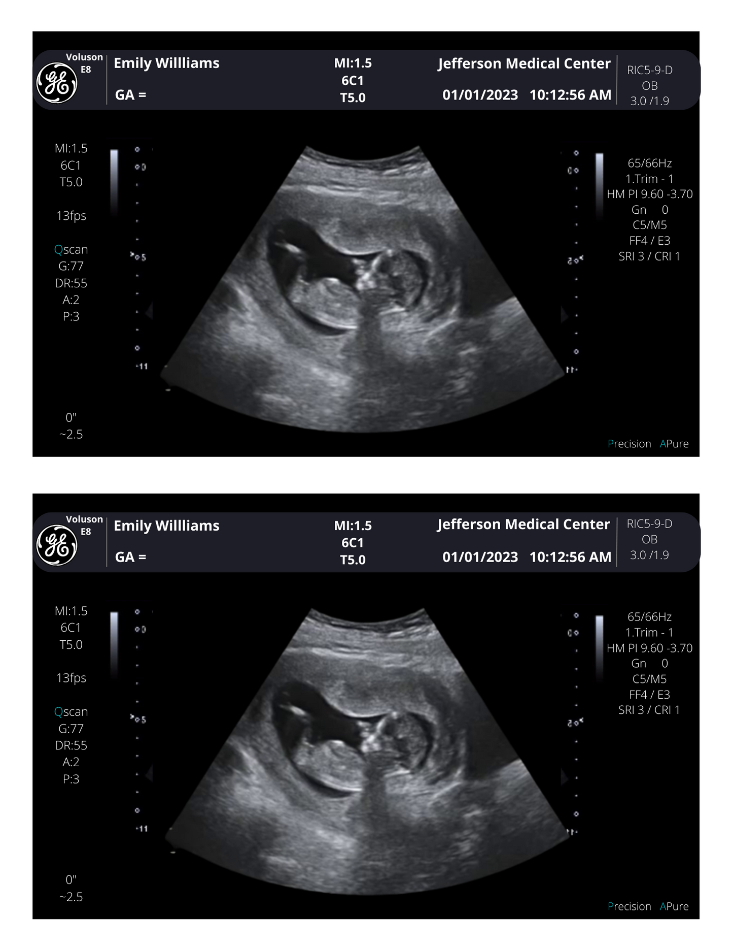 From 3-40 weeks Pregnancy Photo Scan! Personalized Fake Sonogram Picture!! Customizable Digital Ultrasound Downloads |