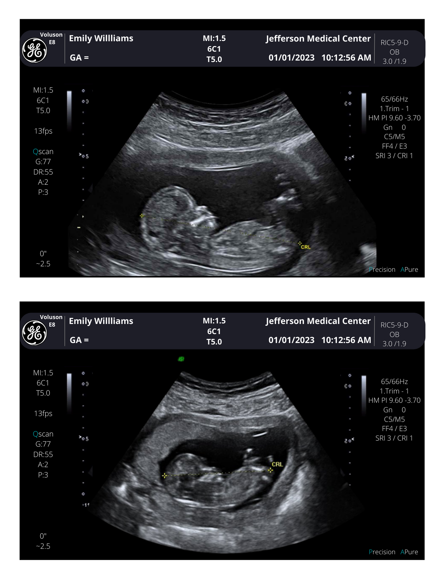 PNG Formats Customizable Digital Ultrasound Downloads | Fake Sonogram Picture |