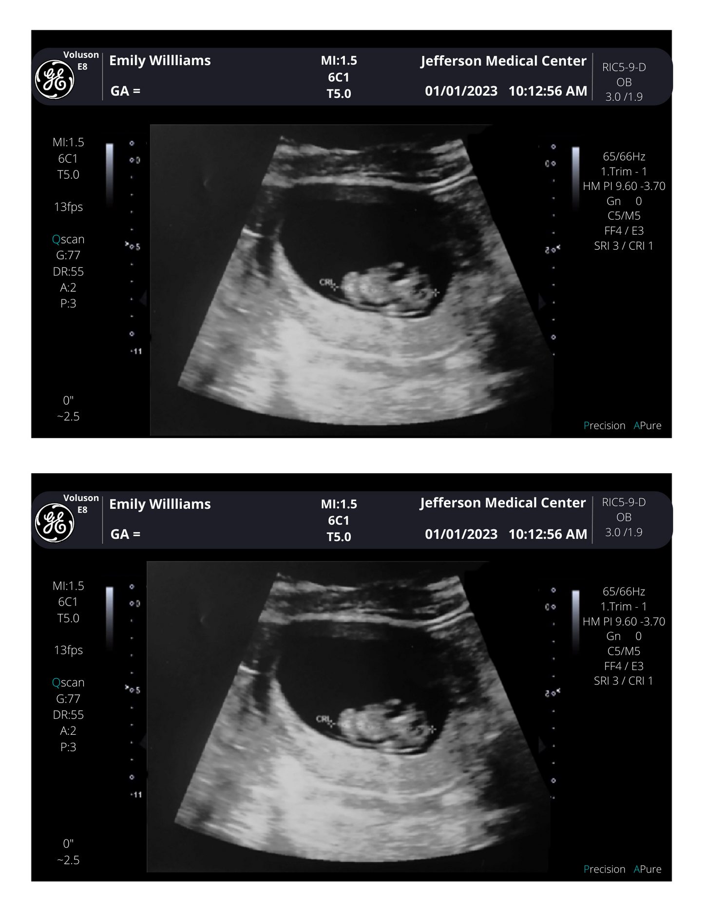 PRINTED & SHIPPED!!  Customizable Sonogram Picture | Personalized Fake Ultrasound Picture |