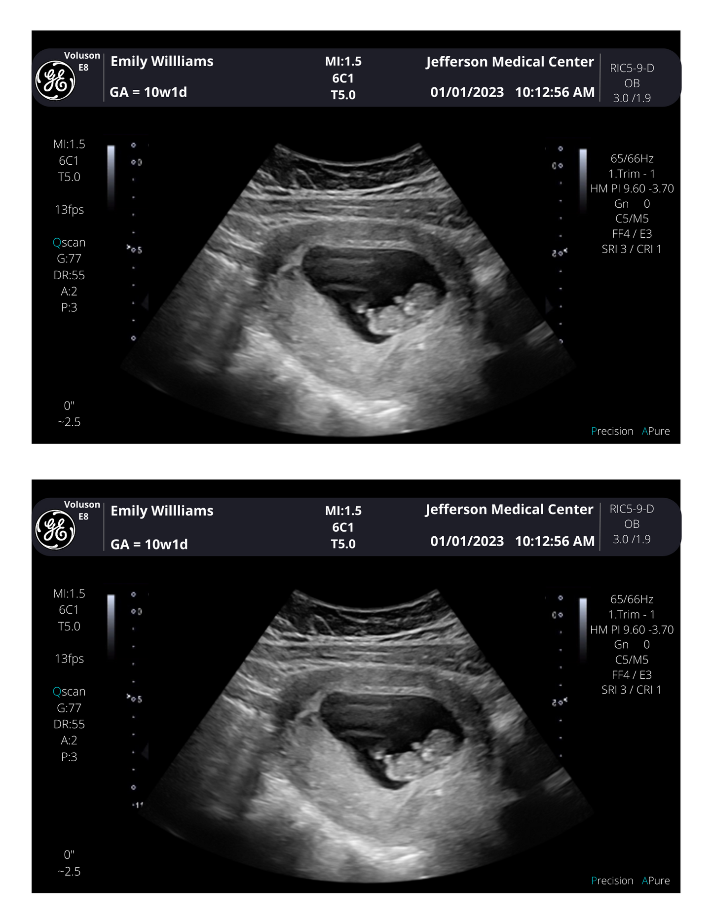 From 3-40 weeks Pregnancy Photo Scan! Personalized Fake Sonogram Picture!! Customizable Digital Ultrasound Downloads |