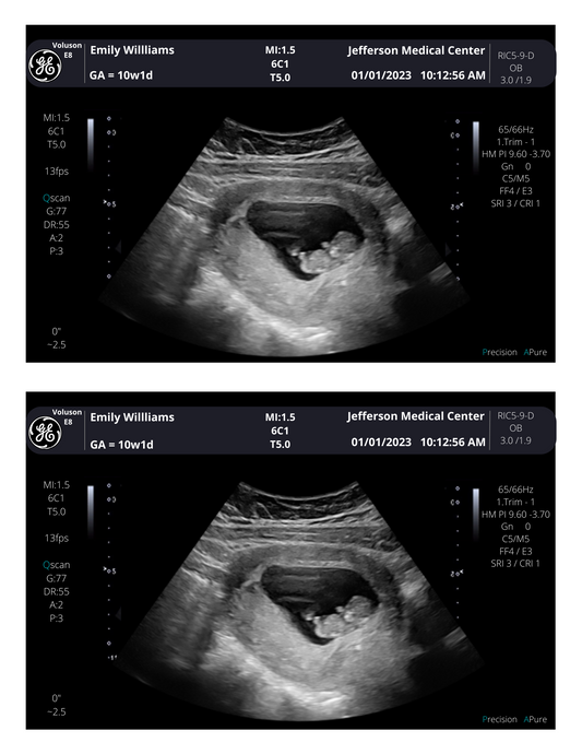 Pregnancy Photo Scan! From 3-40 weeks | Personalized Fake Sonogram Picture!! Customizable Digital Ultrasound Downloads |