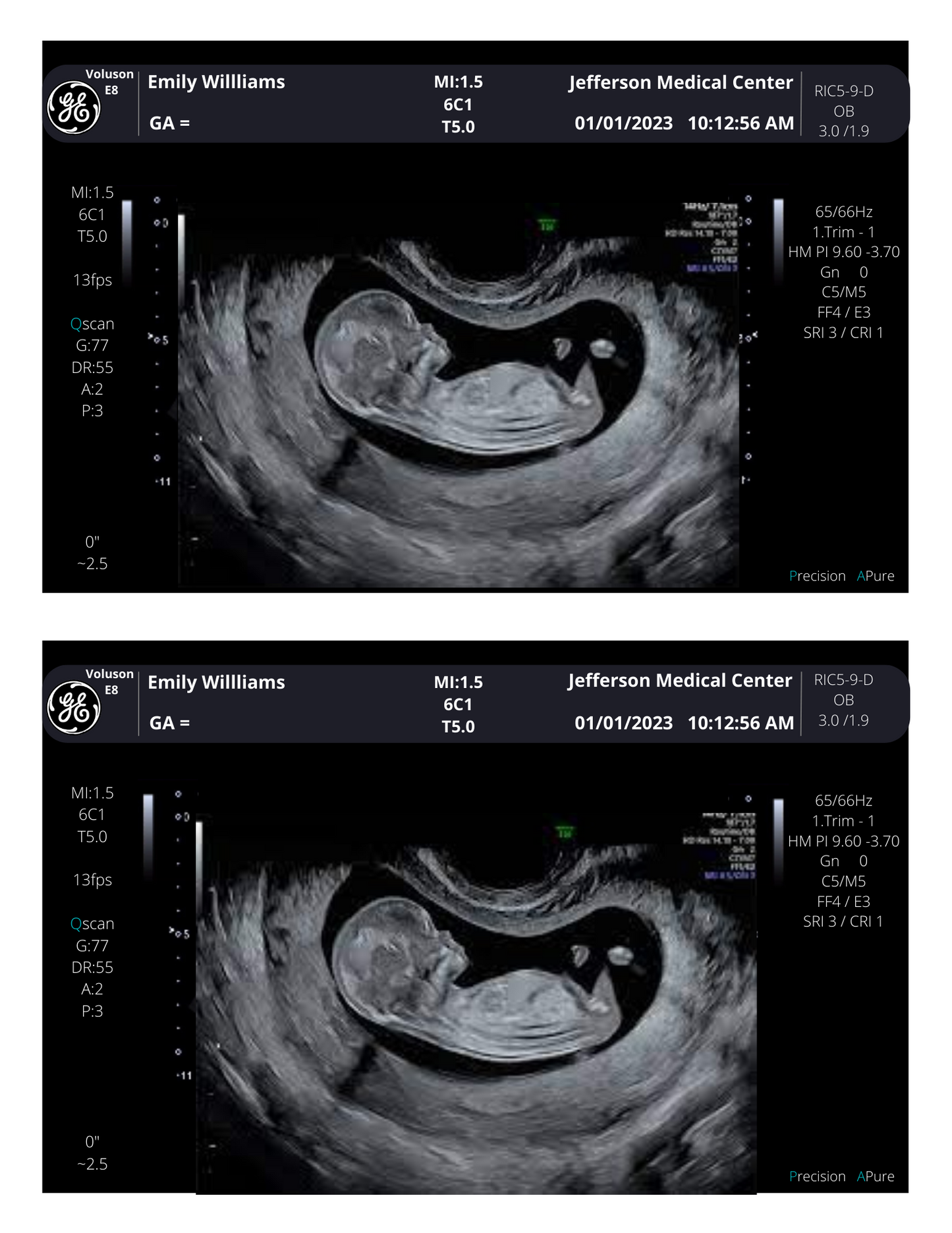 Personalized Fake Ultrasound Sonogram Picture!! From 3-40 weeks!