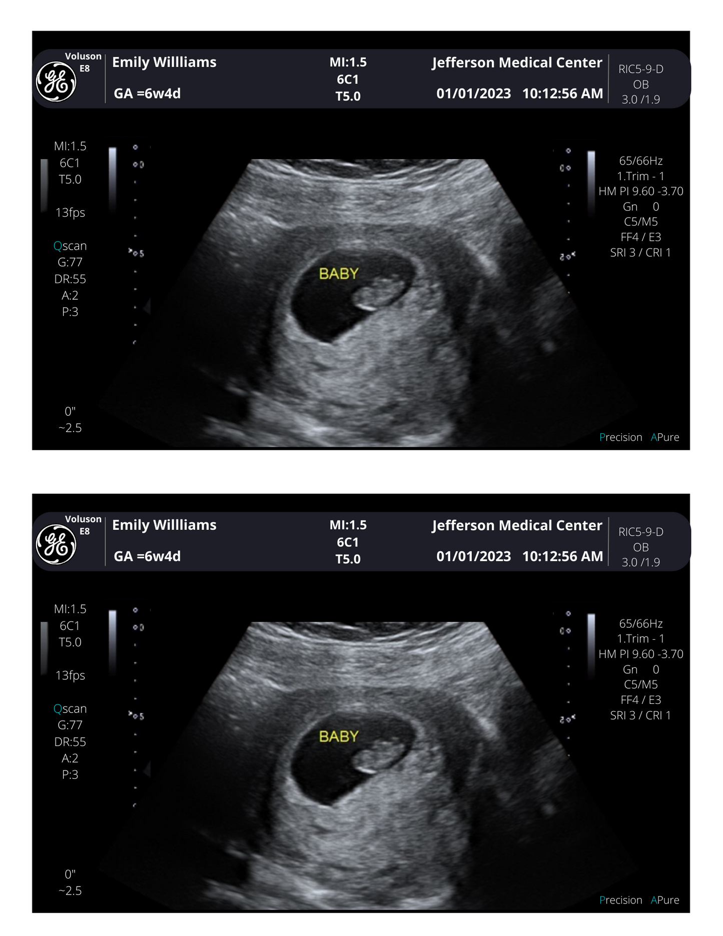 PRINTED & SHIPPED! Personalized Fake Ultrasound Scan | Customizable Sonogram Picture |