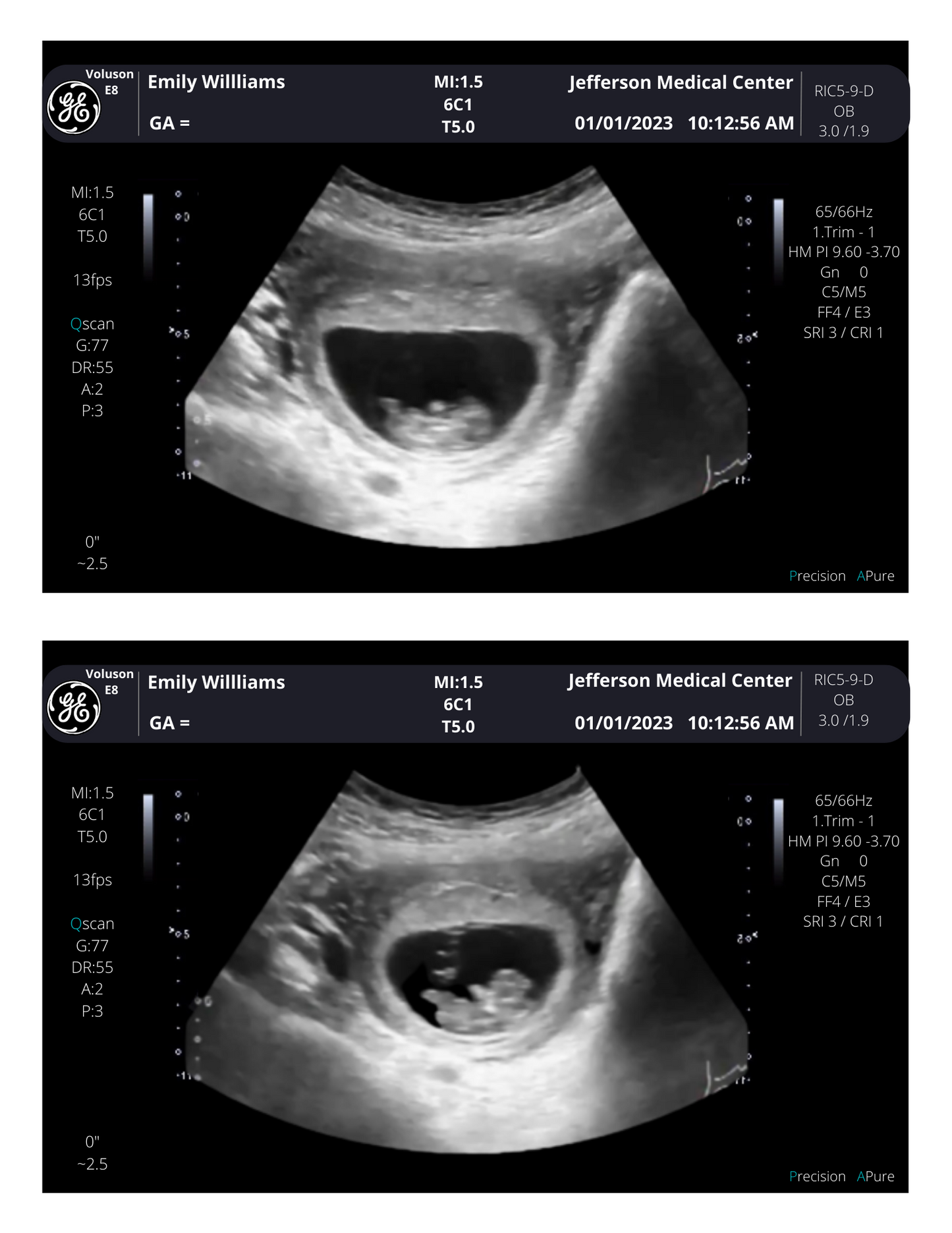 Personalized Fake Ultrasound Sonogram Picture!! From 3-40 weeks!