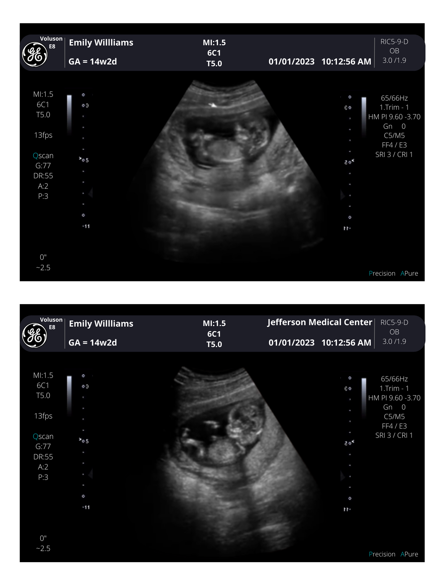 On SALE!! Fake Ultrasound Picture | INSTANT DOWNLOAD!! Customized Digital Sonogram Picture |