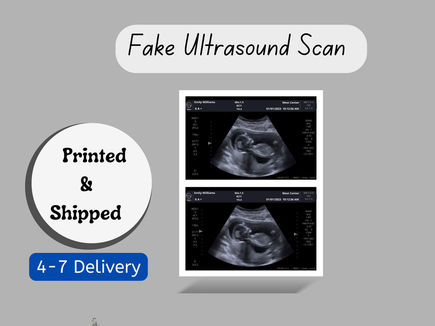 PRINTED & SHIPPED!!  Customizable Sonogram Picture | Personalized Fake Ultrasound Picture |