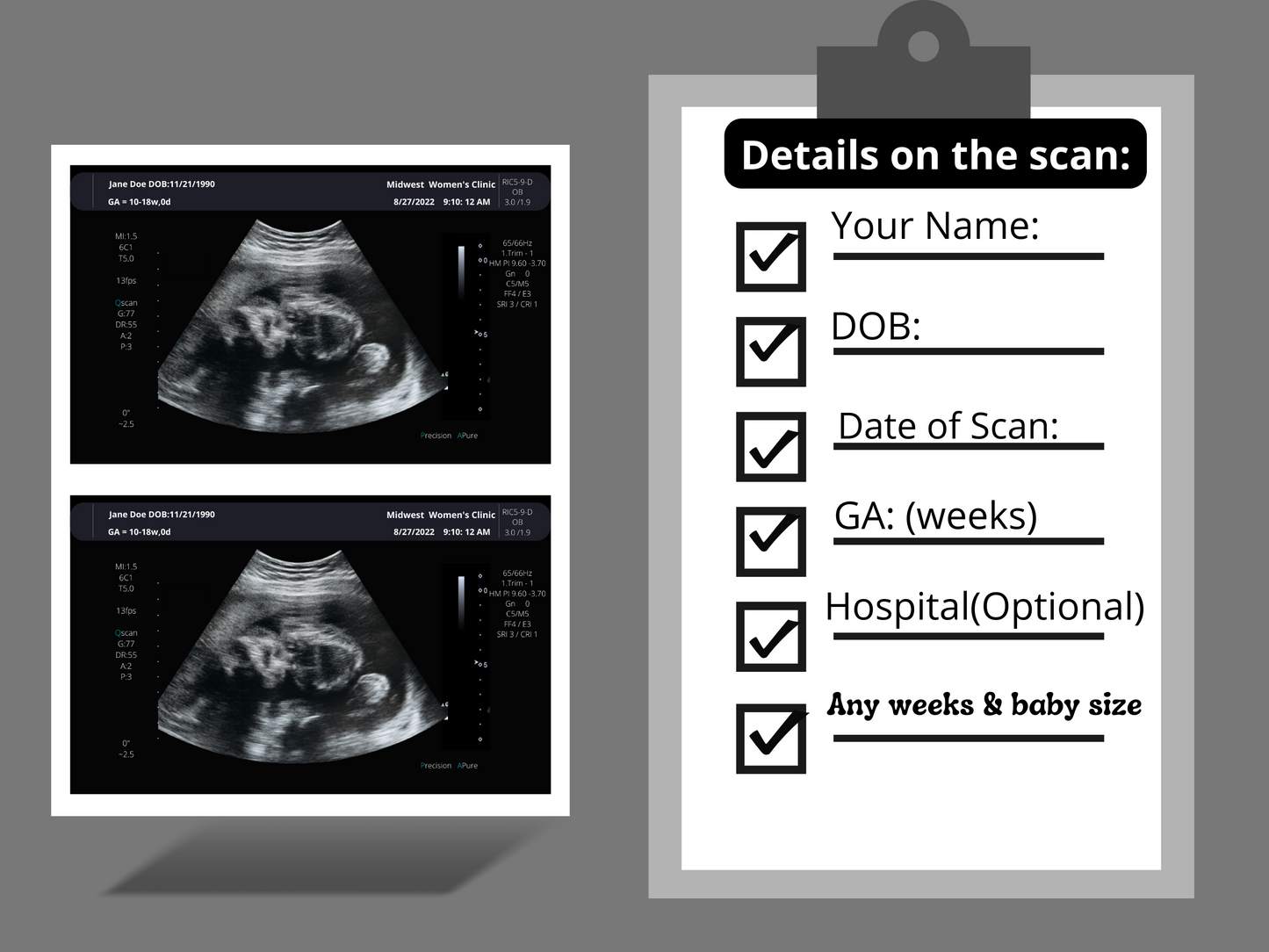 PRINTED & SHIPPED!!  Customizable Sonogram Picture | Personalized Fake Ultrasound Picture |