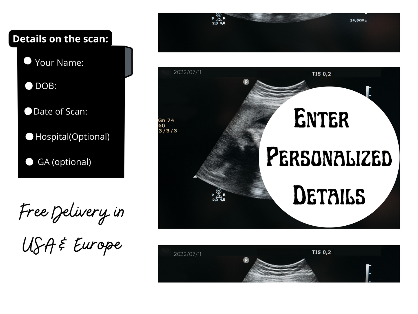 PRINTED & SHIPPED! Personalized Fake Ultrasound Scan | Customizable Sonogram Picture |