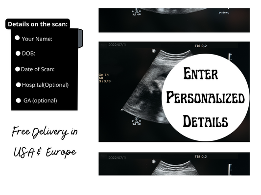 Personalized Fake Ultrasound Picture | PRINTED & SHIPPED!!  Customizable Sonogram Picture |