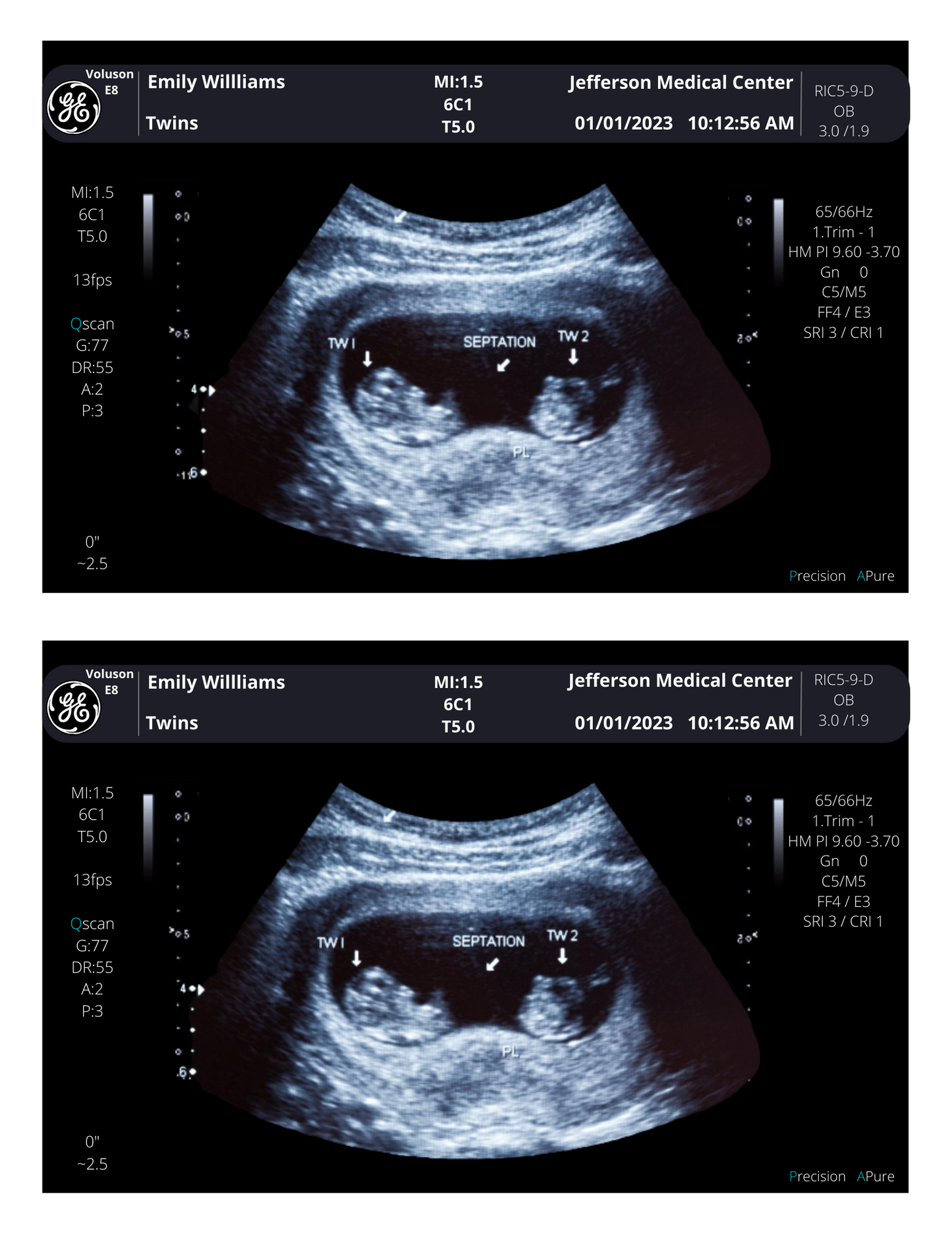 On SALE!! Fake Ultrasound Picture | INSTANT DOWNLOAD!! Customized Digital Sonogram Picture |