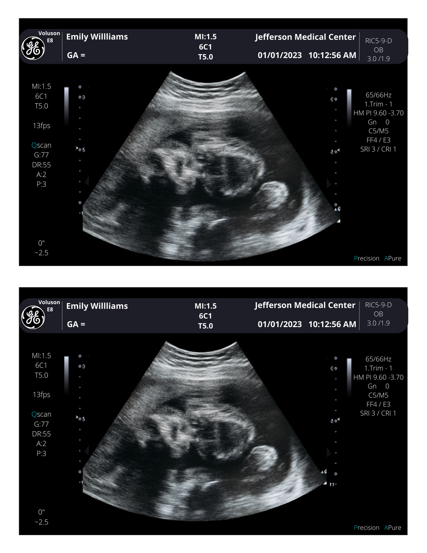 Pregnancy Photo Scan! From 3-40 weeks | Personalized Fake Sonogram Picture!! Customizable Digital Ultrasound Downloads |