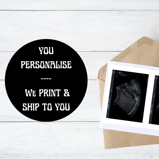 PRINTED & SHIPPED!!  Customizable Sonogram Picture | Personalized Fake Ultrasound Picture |