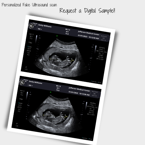 On SALE!! Fake Ultrasound Picture | INSTANT DOWNLOAD!! Customized Digital Sonogram Picture |
