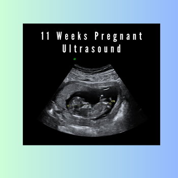 11 Weeks Pregnant Ultrasound: Capturing the Wonder of Your Growing Bab ...