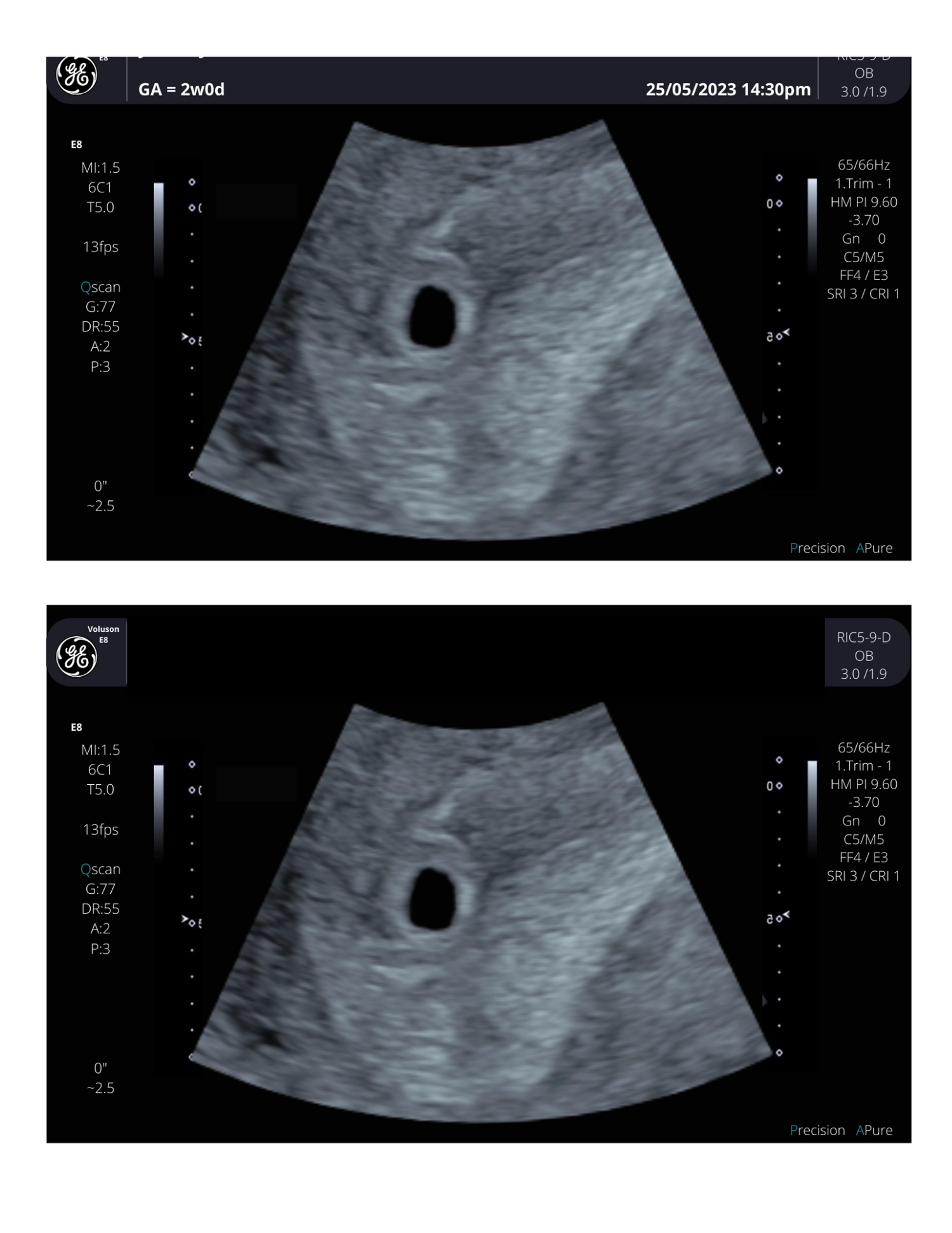 4-weeks-pregnant-ultrasound-your-first-glimpse-into-pregnancy-creetify