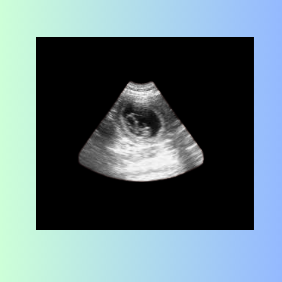 7 Weeks Pregnant Ultrasound: Your Baby's Progress and What to Expect