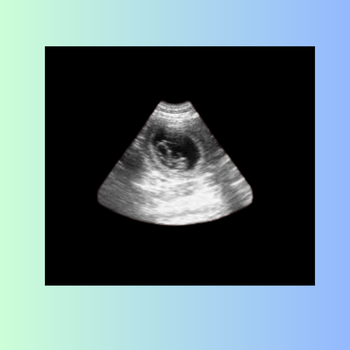 7 Weeks Pregnant Ultrasound: Your Baby's Progress and What to Expect ...