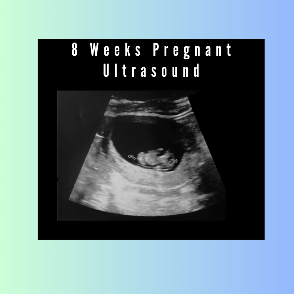 Ultrasounds Blog Posts: From 1-12 Weeks Pregnancy Scan – creetify