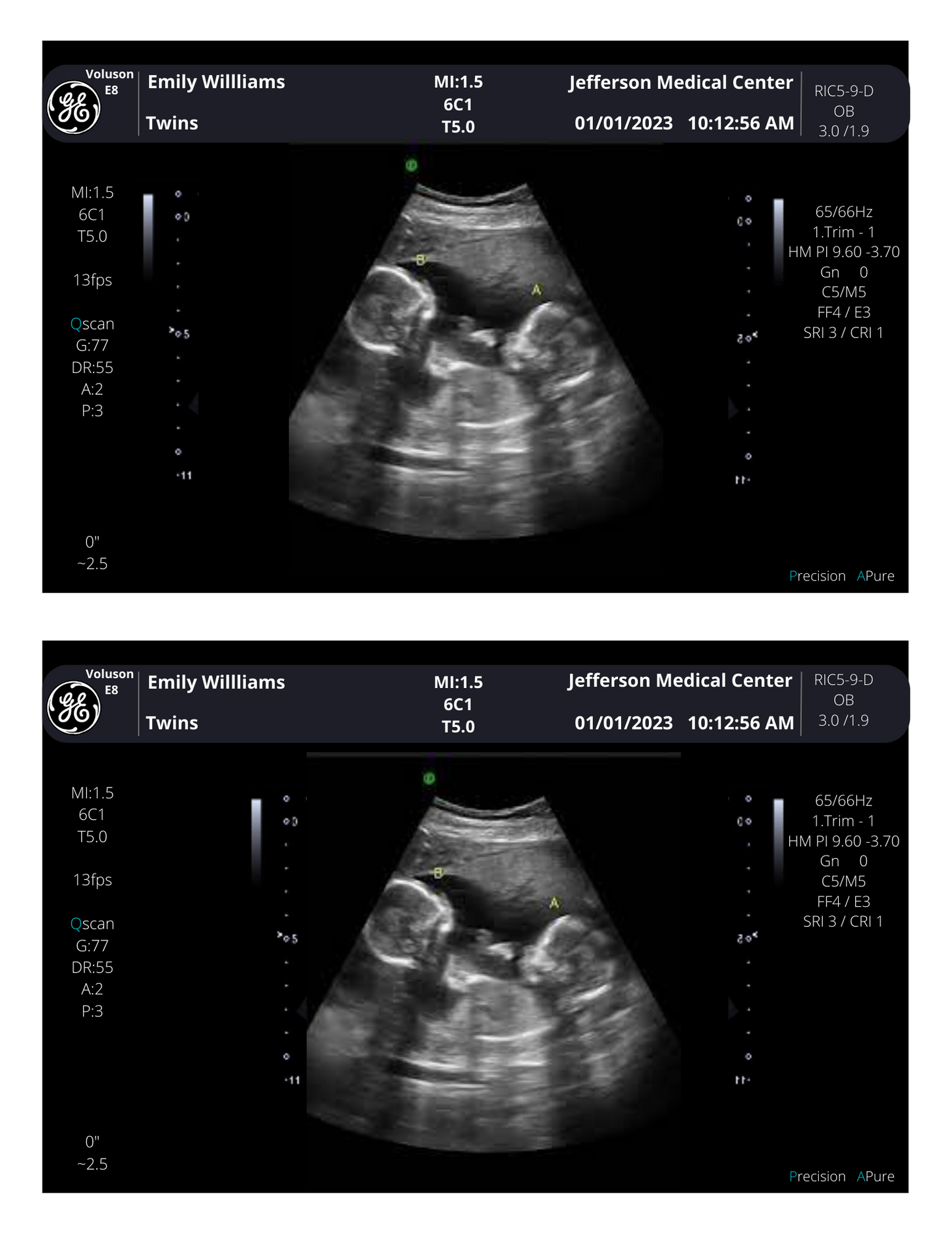 Fake Ultrasound for Twins