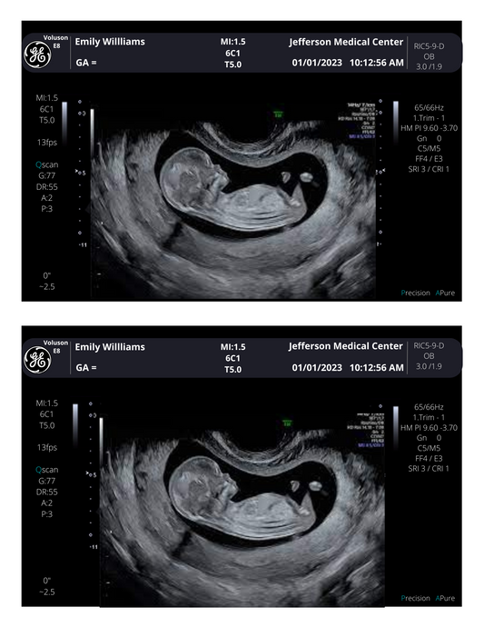 Fake Ultrasound Picture tagged "fake ultrasound picture" creetify