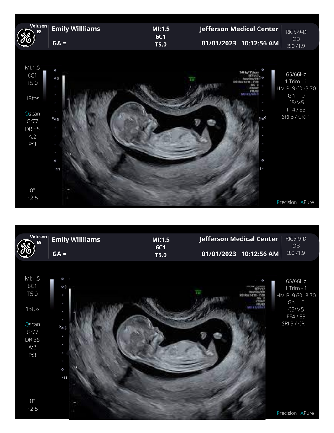 Fake Ultrasound Picture Tagged Fake Ultrasound Picture Creetify