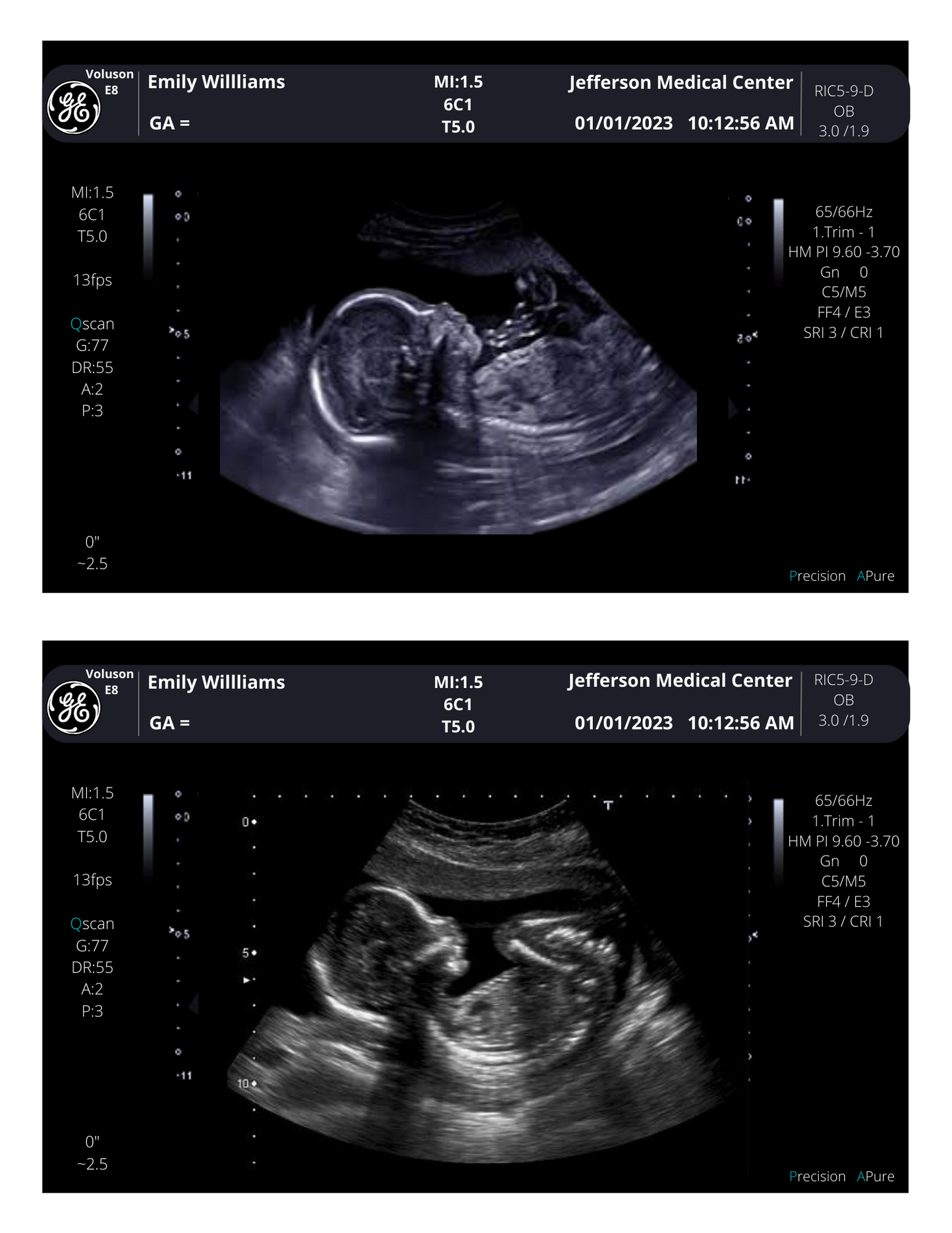 On SALE!! Fake Ultrasound Picture | INSTANT DOWNLOAD!! Customized Digital Sonogram Picture |