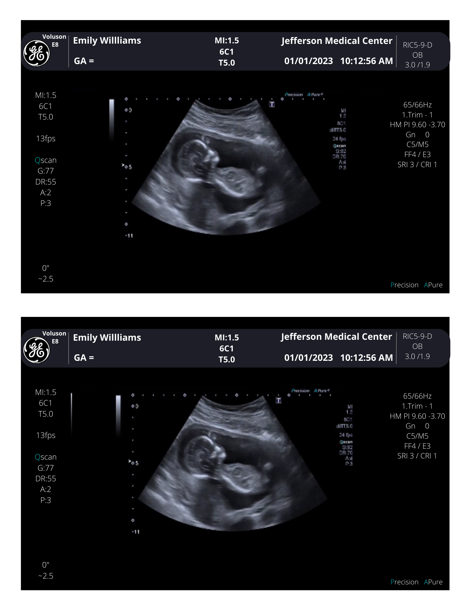 PNG Formats Customizable Digital Ultrasound Downloads | Fake Sonogram