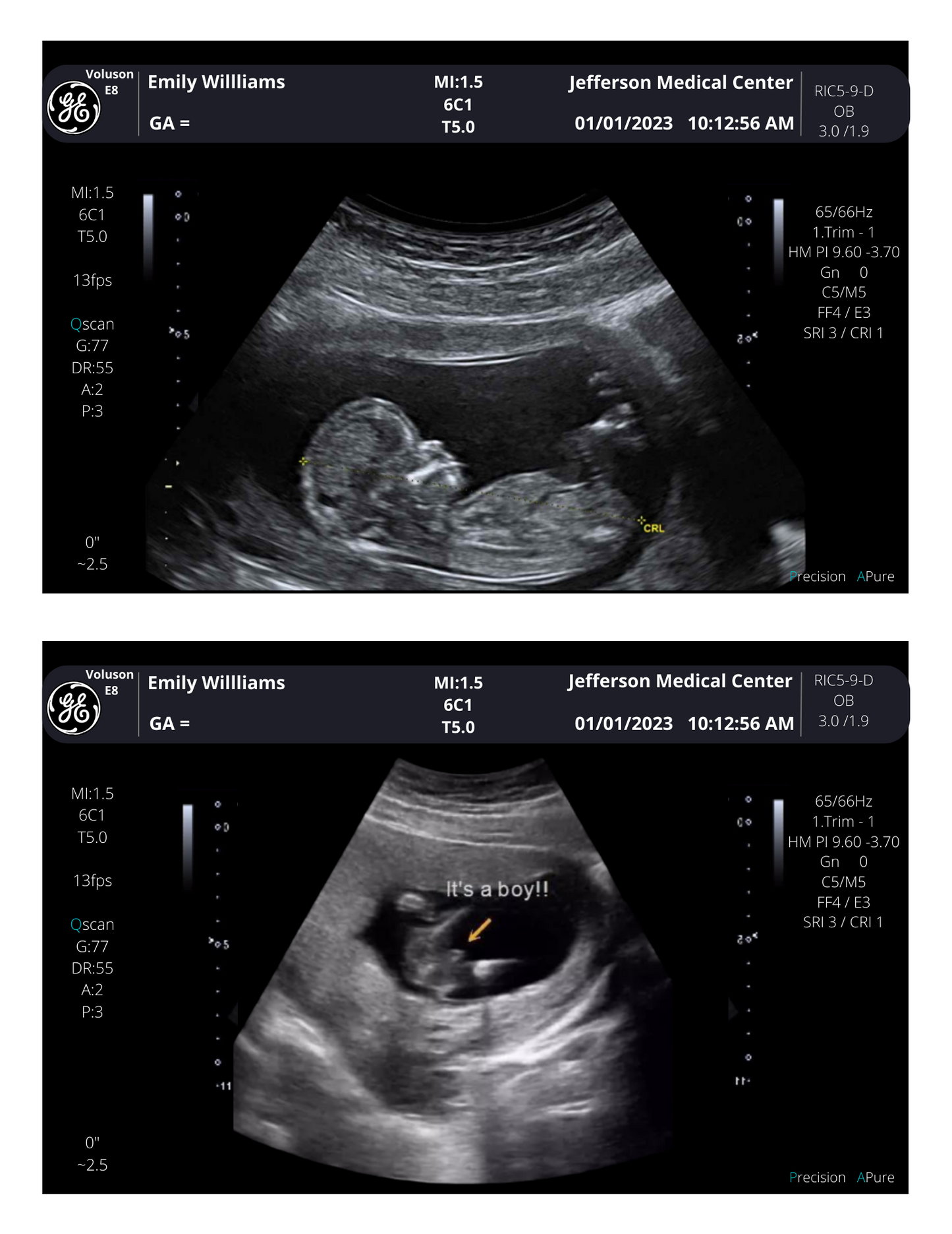 From 3-40 weeks Pregnancy Photo Scan! Personalized Fake Sonogram Picture!! Customizable Digital Ultrasound Downloads |