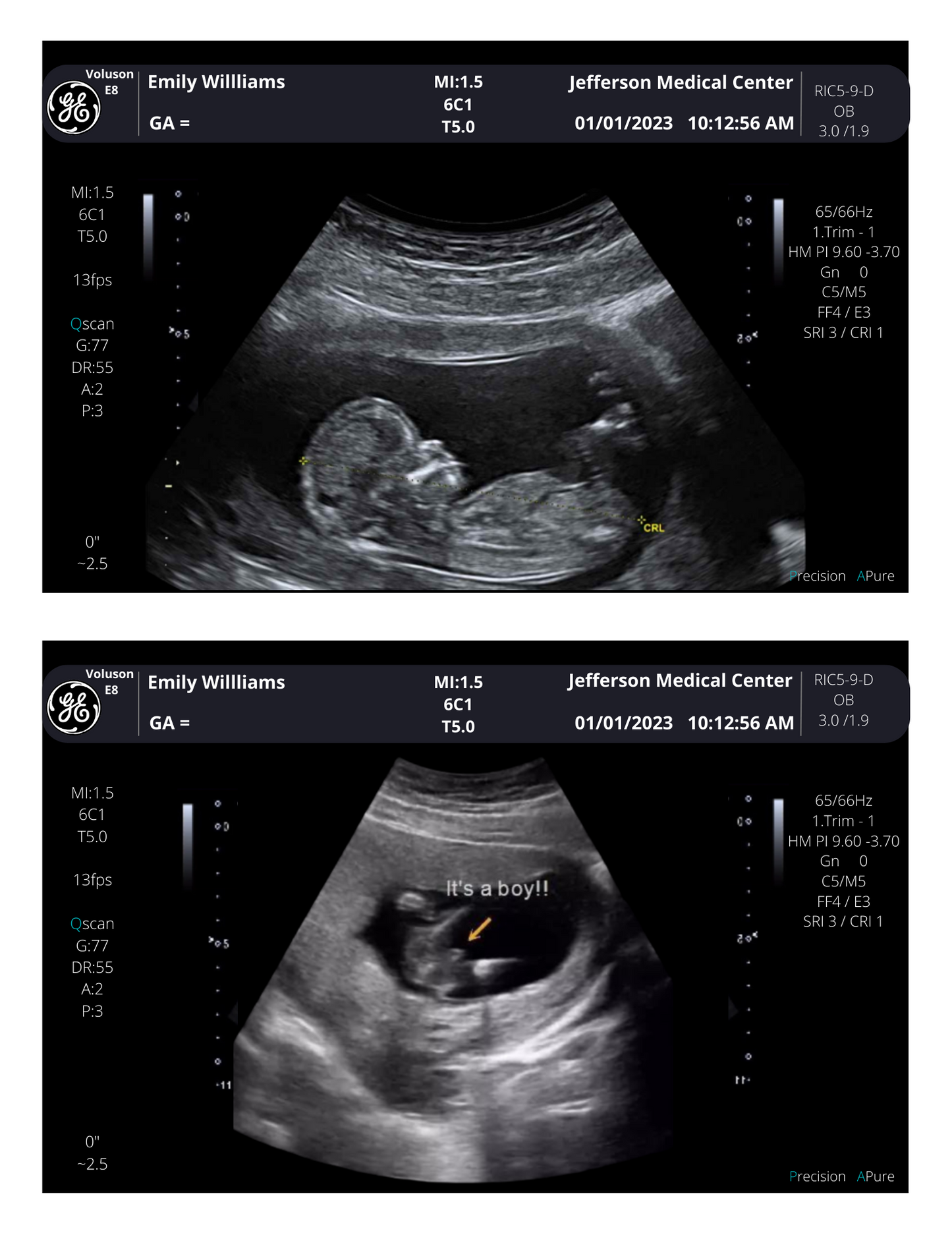 On SALE!! Fake Ultrasound Picture | INSTANT DOWNLOAD!! Customized Digital Sonogram Picture |