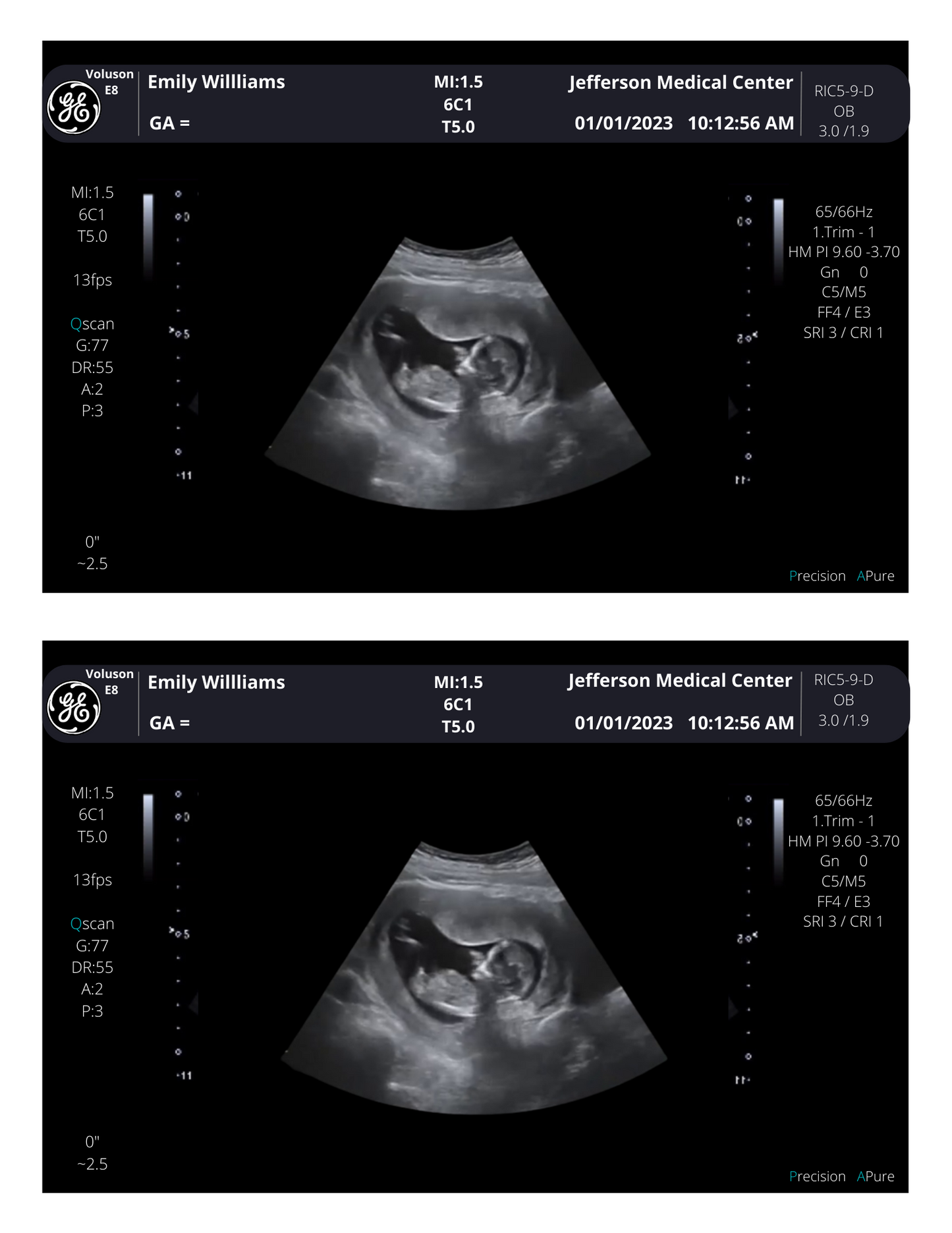Customizable Digital Ultrasound Downloads | Fake Sonogram Picture |