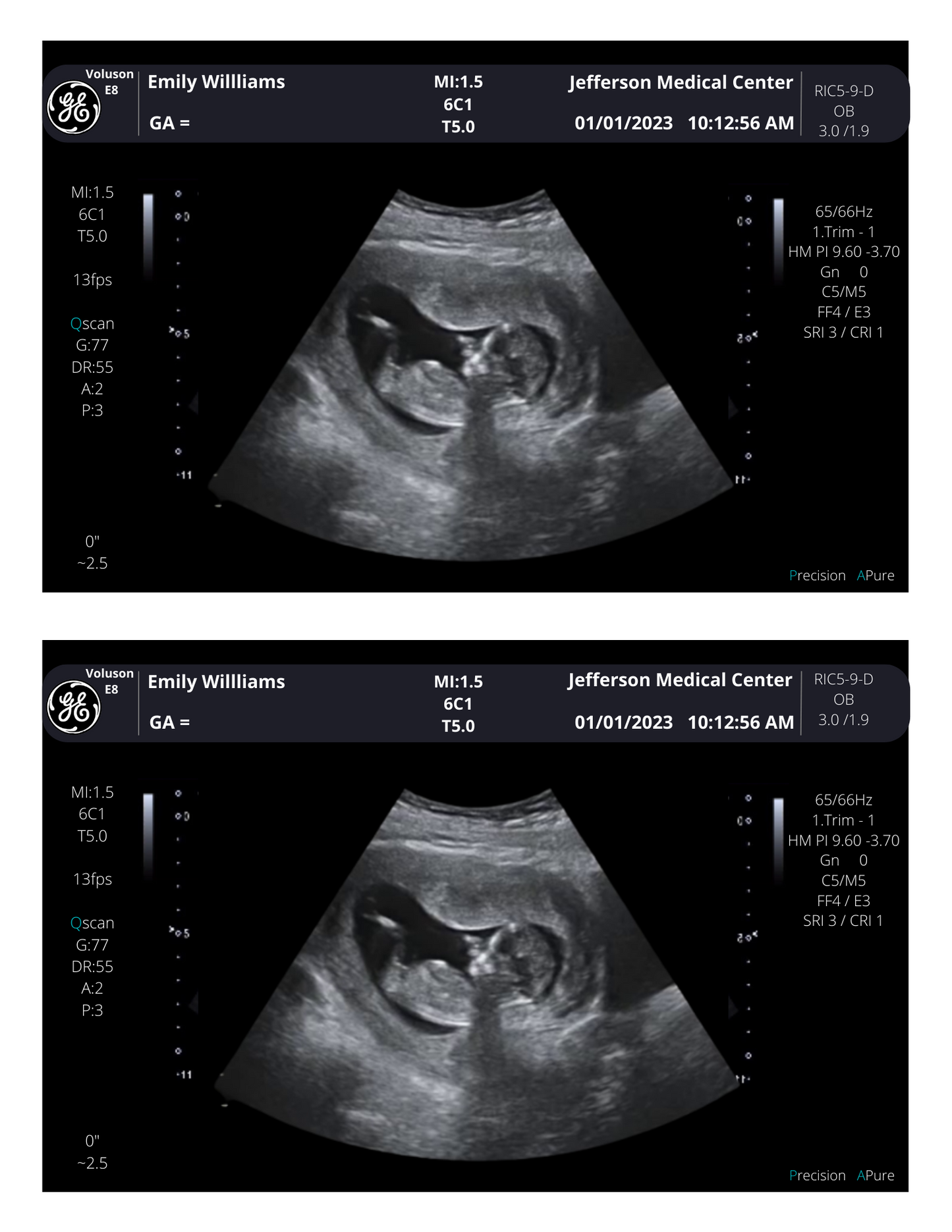 Personalized Fake Ultrasound Sonogram Picture!! From 3-40 weeks!