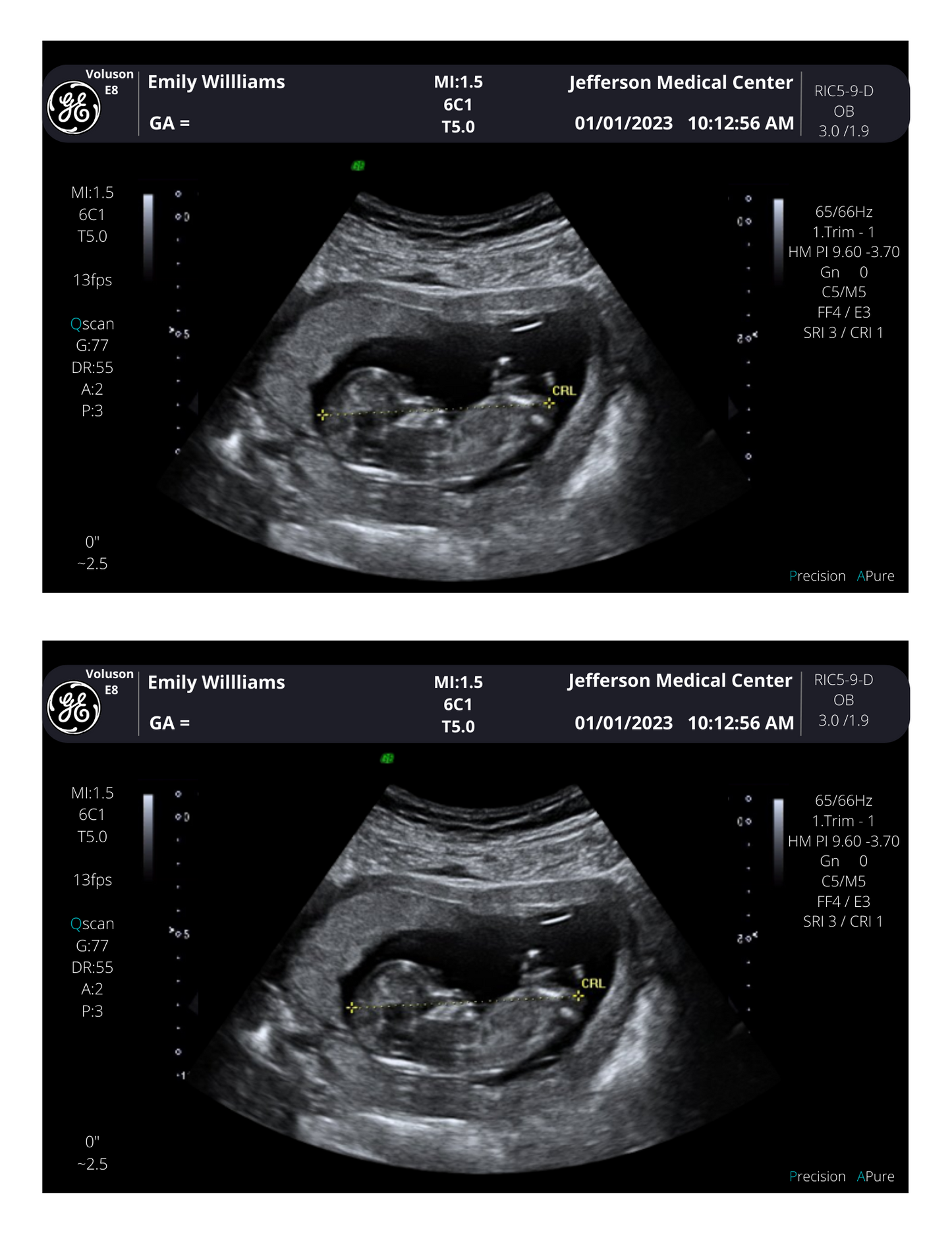 Twins Fake Sonogram Picture!! From 3-40 weeks! | Customizable Digital Twin Ultrasound Picture  |