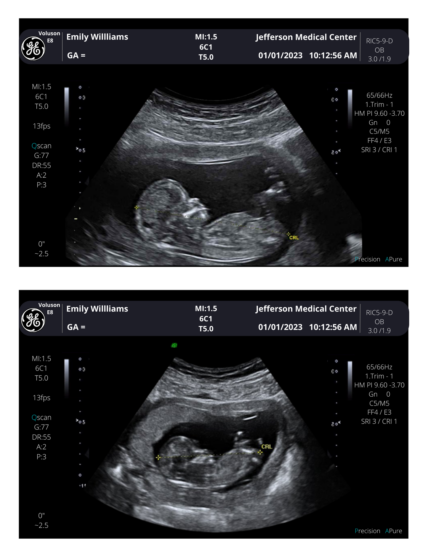 Personalized Fake Ultrasound Picture | PRINTED & SHIPPED!!  Customizable Sonogram Picture |