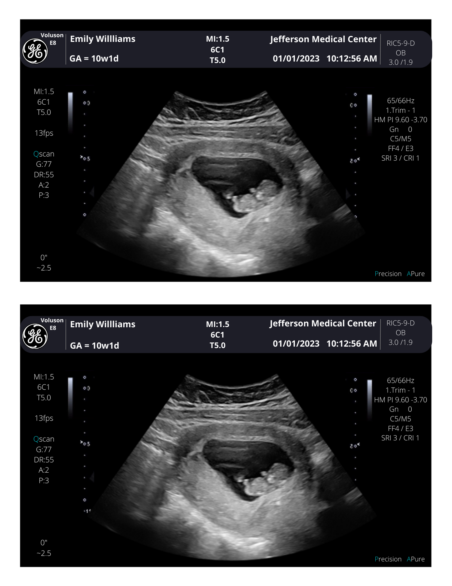 Personalized Fake Ultrasound Picture | PRINTED & SHIPPED!!  Customizable Sonogram Picture |