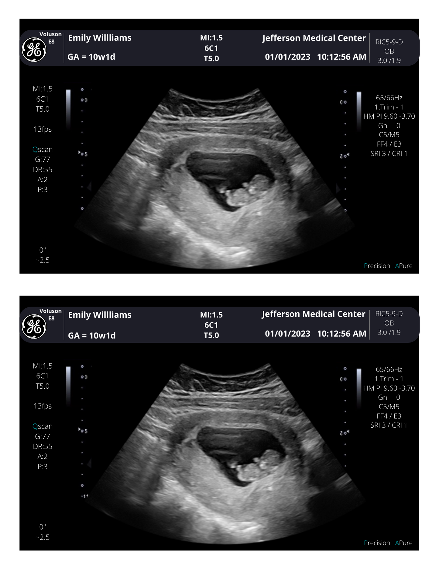 Pregnancy Photo Scan! From 3-40 weeks | Personalized Fake Sonogram Picture!! Customizable Digital Ultrasound Downloads |