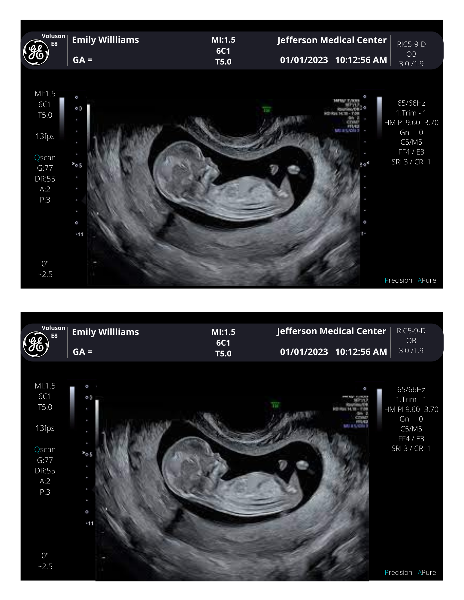 Personalized Fake Ultrasound Sonogram Picture!! From 340 weeks! creetify