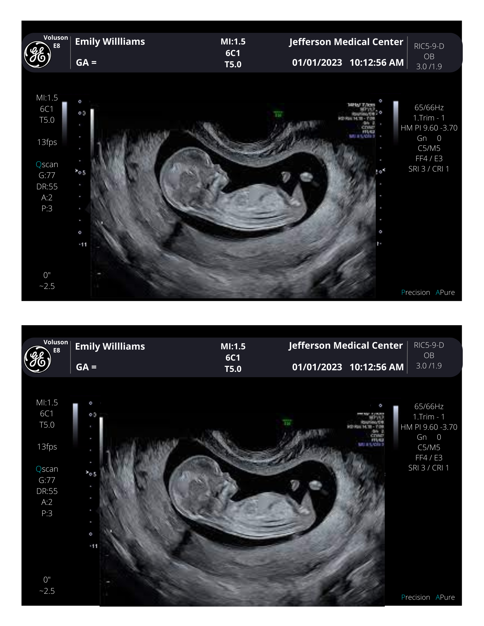 Personalized Fake Ultrasound Sonogram Picture From 3 40 Weeks Creetify personalized-fake-ultrasound-sonogram-picture-from-3-40-weeks-creetify
