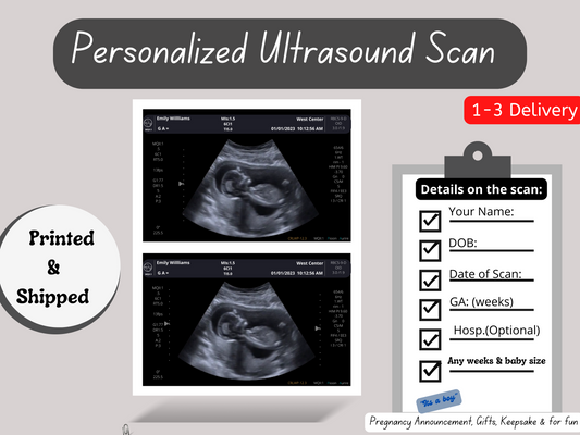 PRINTED & SHIPPED! Personalized Fake Ultrasound Scan | Customizable Sonogram Picture |
