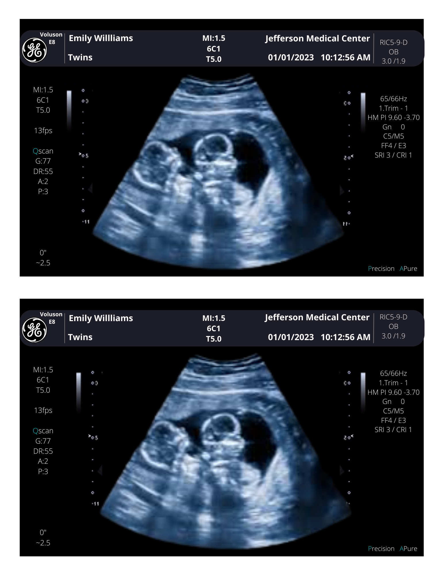 Make Fake Ultrasound Picture.html