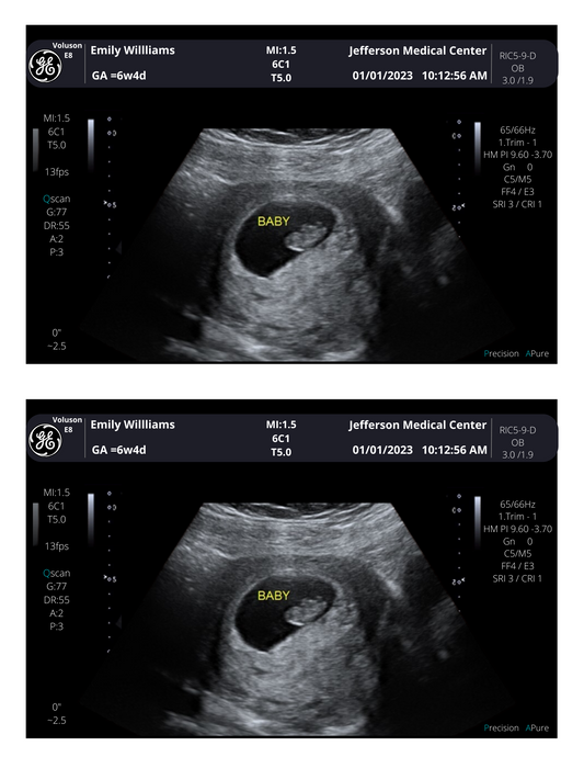 Fake Ultrasound Picture tagged "fake ultrasound picture" creetify