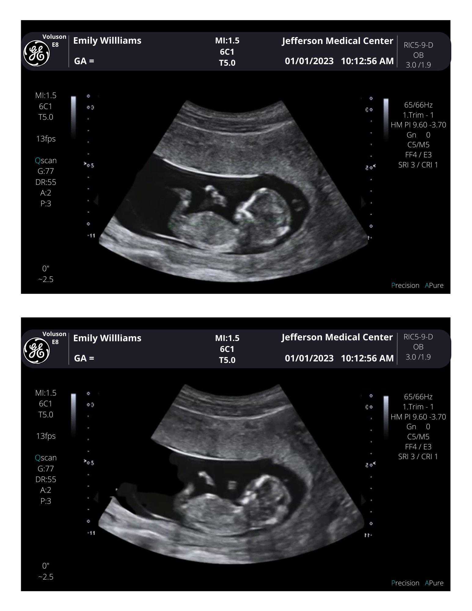 Fake Sonogram.html