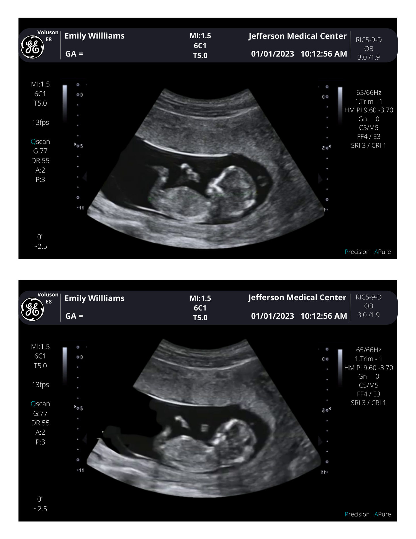 Customizable Digital Ultrasound Downloads | Fake Sonogram Picture |